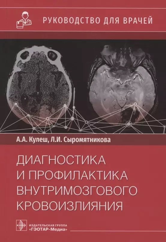 

А. А. Кулеш, Л. І. Сиромятникова: Діагностика та профілактика внутрішньомозкового крововиливу. Посібник для лікарів